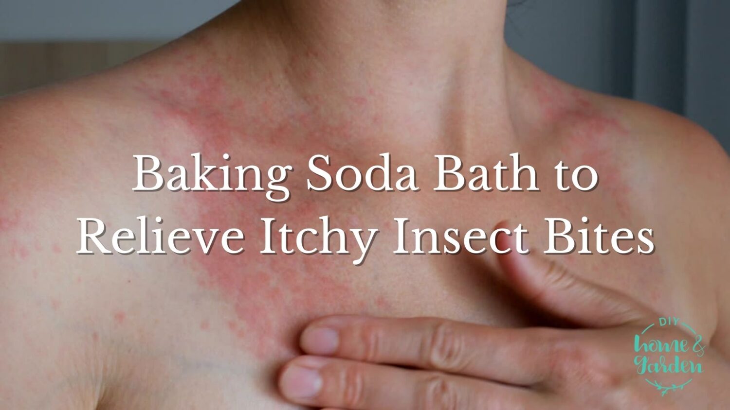 Baking Soda Bath Recipe to Relieve Itchy Insect bites (comfort your skin)